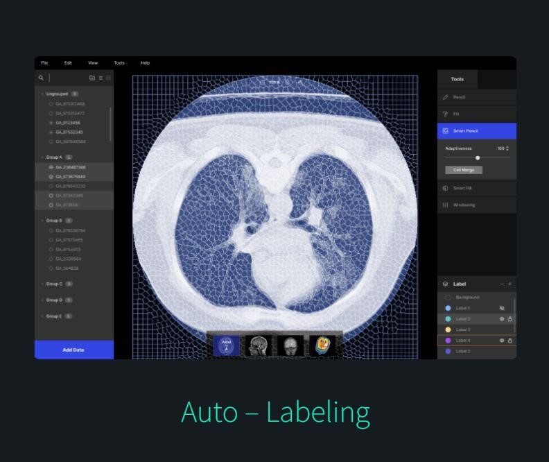 재이랩스 ‘메디라벨’ 오토라벨링 화면 샘플