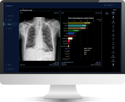 제이엘케이의 제이뷰어엑스(JVIEWER-X)