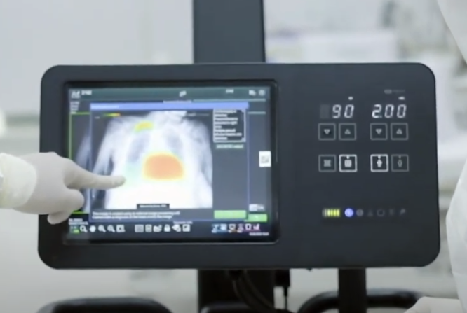후지필름 엑스레이 장비에서 이상 부위를 표시하고 있는 ‘루닛 인사이트 CXR’