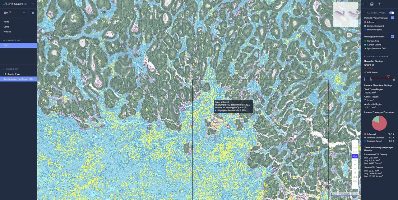 루닛의 AI 바이오마커 플랫폼 ‘루닛 스코프 IO’
