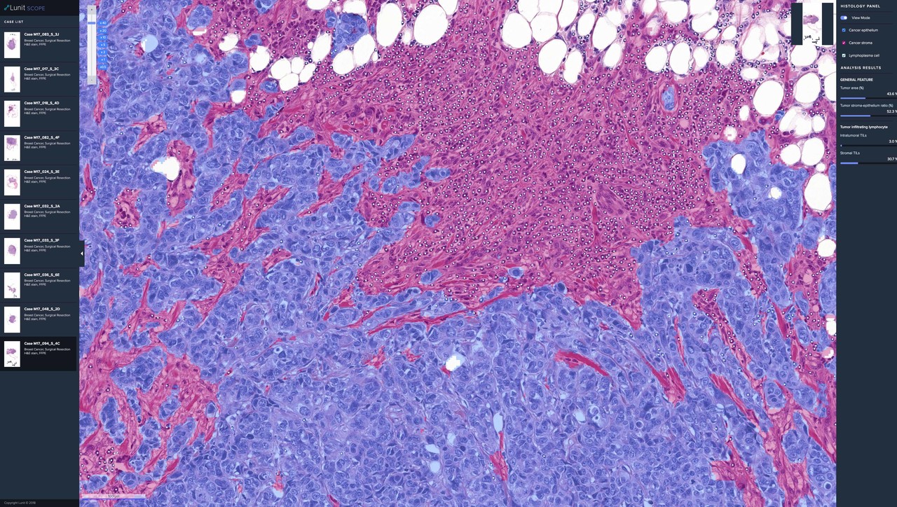 루닛 AI 바이오마커 플랫폼 ‘루닛 스코프 IO(Lunit SCOPE IO)’