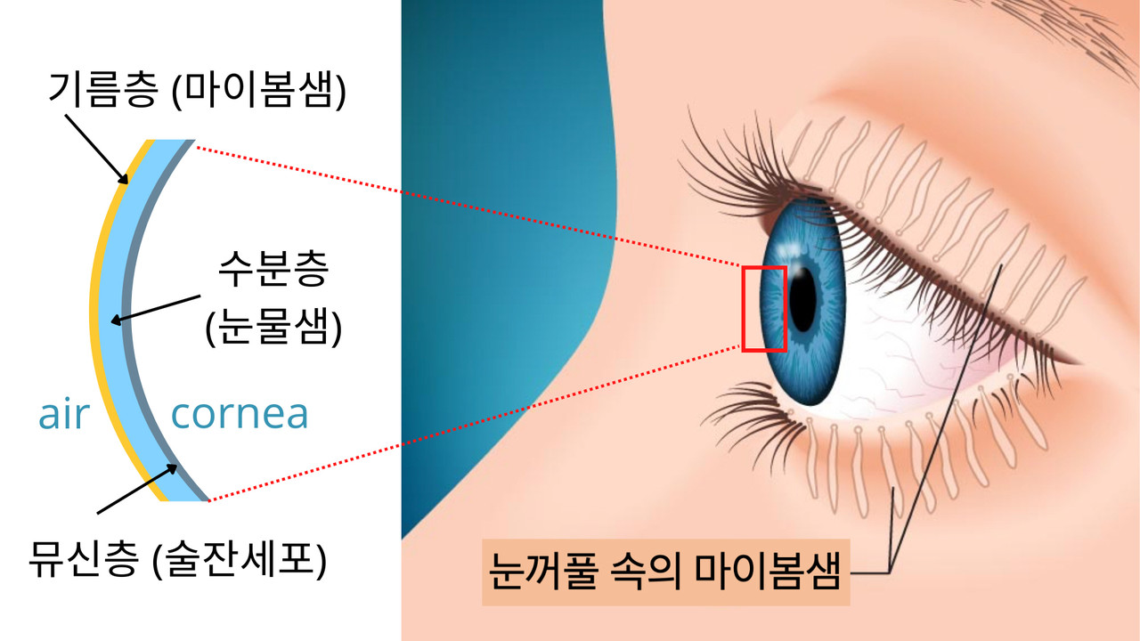 눈꺼풀 속 마이봄샘과 눈물층 설명도. 눈물막은 크게 뮤신층(mucin layer), 수분층(aqueous layer), 기름층(lipid layer)으로 구성되어 있는데, 이 중 눈을 많이 사용하는 현대인에게 가장 많이 발생하는 것은 증발성 안구건조증임. 이는 눈꺼풀에 있는 마이봄샘이 기름층을 생성하여 눈물막에 있는 수분이 공기 중으로 증발하지 않도록 해야 하는데 이 기능이 저하되거나 마이봄샘이 소실되어 발생한다. [사진=지스트]