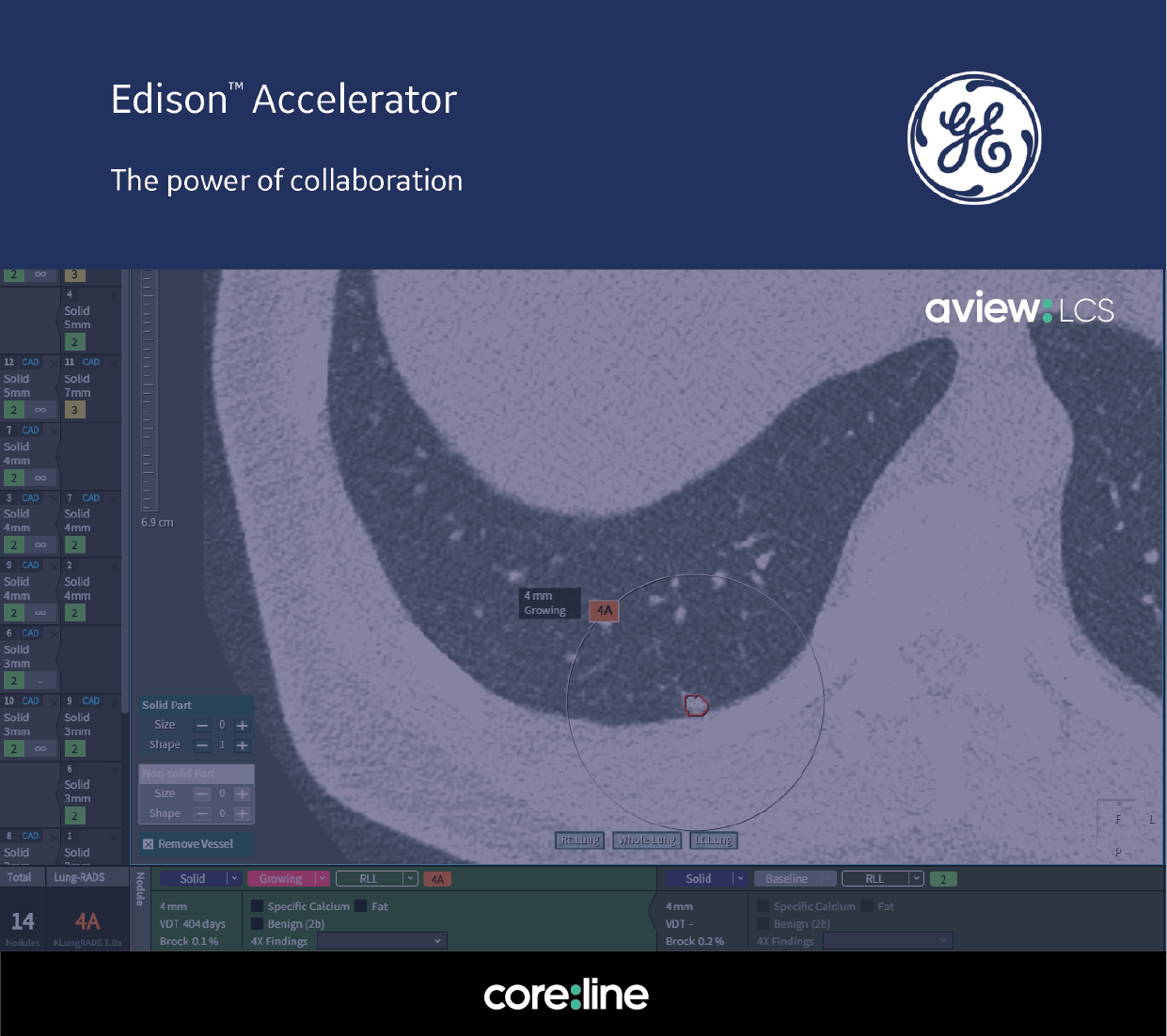 코어라인소프트가 Edison Accelerator에 최종 선정됐다. [사진=코어라인소프트]