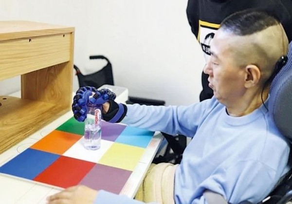 중국 칭화대가 공개한 첫 NEO 이식 환자의 모습 [사진=홍콩 명보]